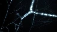 These are the real fungal 'superhighways' that inspired 'The Last of Us.' | Image via National Geographic